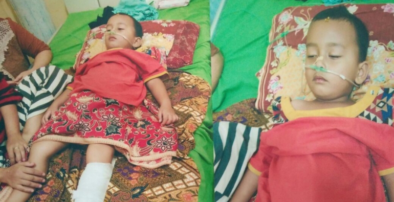 Davi Putra (4), balita asal Kepahiang yang butuh bantuan