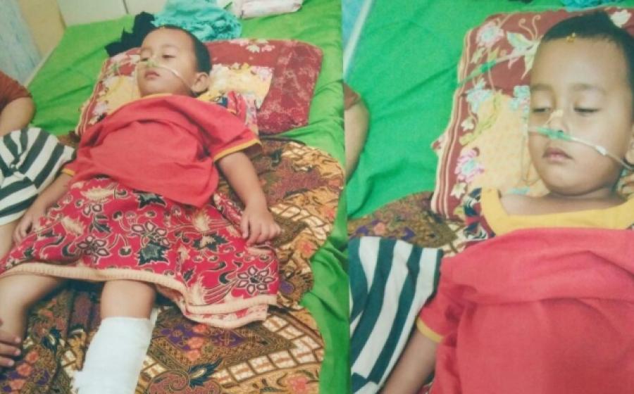 Davi Putra (4), balita asal Kepahiang yang butuh bantuan