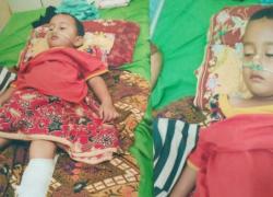 Davi Putra (4), balita asal Kepahiang yang butuh bantuan